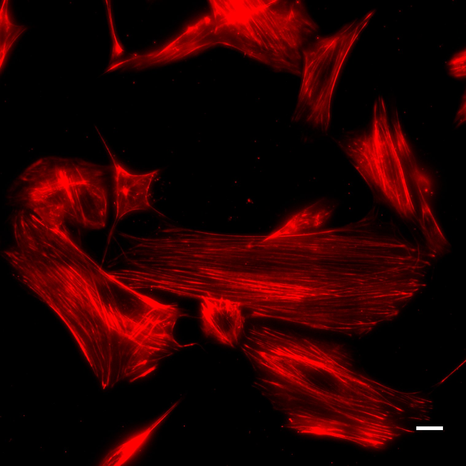 3T3_500nM_SiR700-actin_2