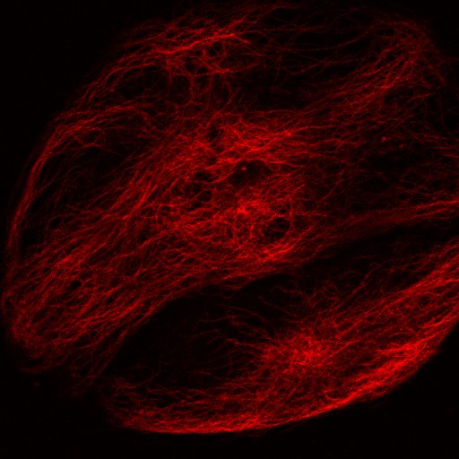 3T3_SiR700-tubulin_confocal