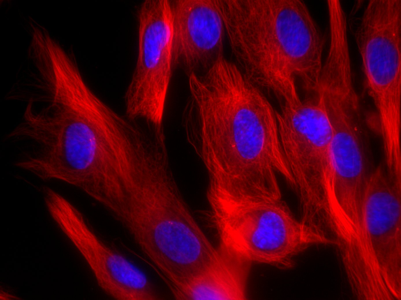 Fibro_SiR700-tubulin