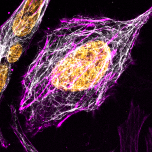 HeLa_SPY555-actin_SPY595-DNA_SPY650-tubulin-1-e1586783871774