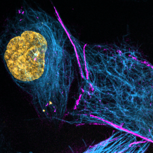 HeLa_SPY555-actin_SPY595-DNA_SPY650-tubulin-e1586609911270
