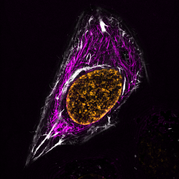 HeLa_SPY555-tubulin_SPY595-DNA_SiR-actin_775nmSTED-e1586610194496