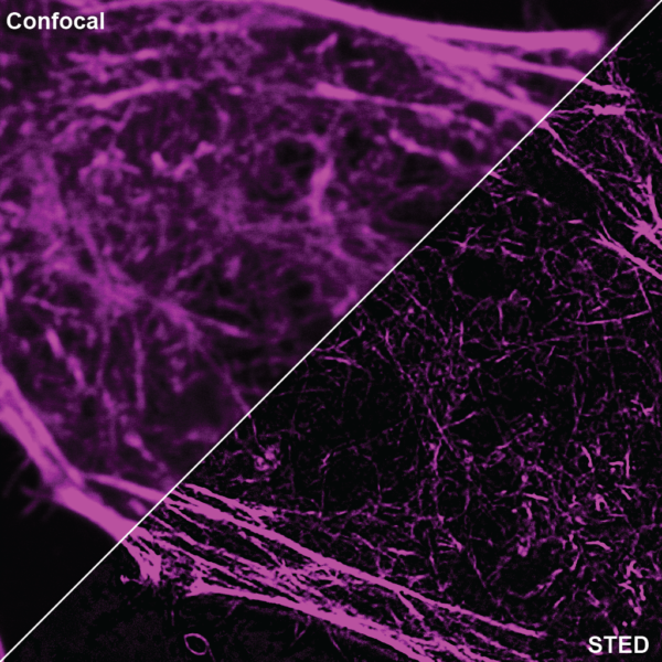 SPY555-actin_conf_vs_STED_2-e1586783650569