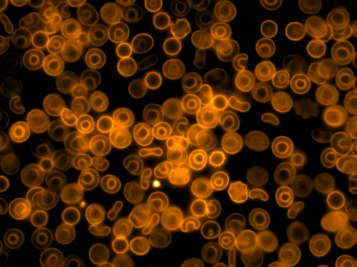 SPY620-actin_RBC_3
