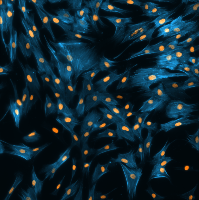 SiR-actin_tilscan_900-e1562161627386