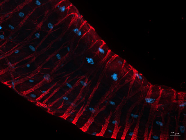 hind-gut-Sir-actin-2h
