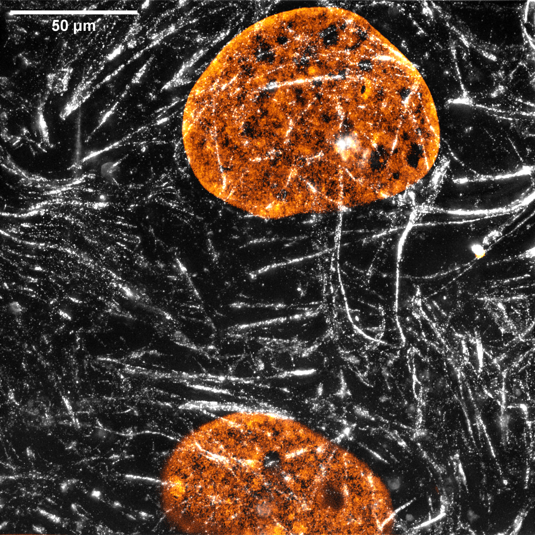 HeLa HAK actin DNA 03
