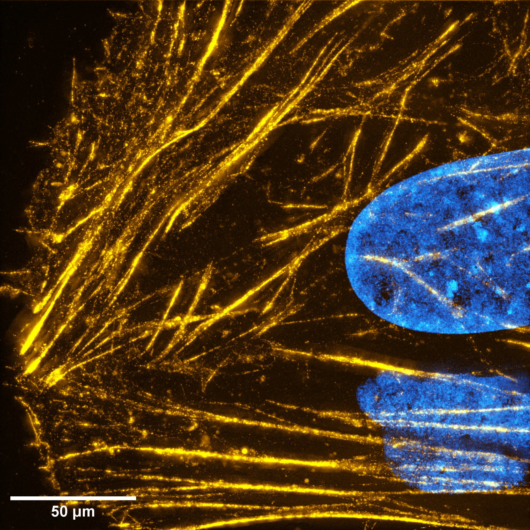 HeLa HAK actin DNA 05