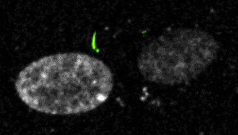 RPE-1_Hoechst_CS650_Cilium_1 RPE 1 Hoechst CS650 Cilium 1